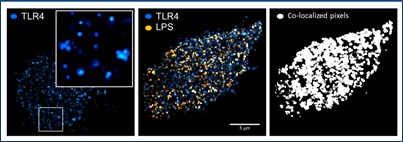 Hyperspectral confocal Raman image of carotenoids and achlorophyll in living Haematococcus pluvialis cells. Upper panel: component spectra. Lower panel: pigment localization, pseudo-colored corresponding to spectra in upper panel. Figure generated by Aaron Collins in collaboration with Thomas Beechem, and Howland Jones at SNL and Dr. Qiang Hu's group at ASU.