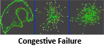 Congestive Failure