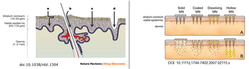 Image of microneedle_overview