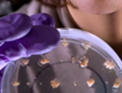 petri dish with microorganism growth