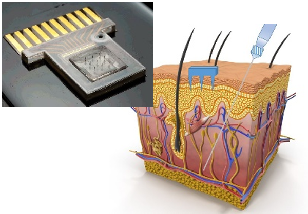 microneedles and application to skin
