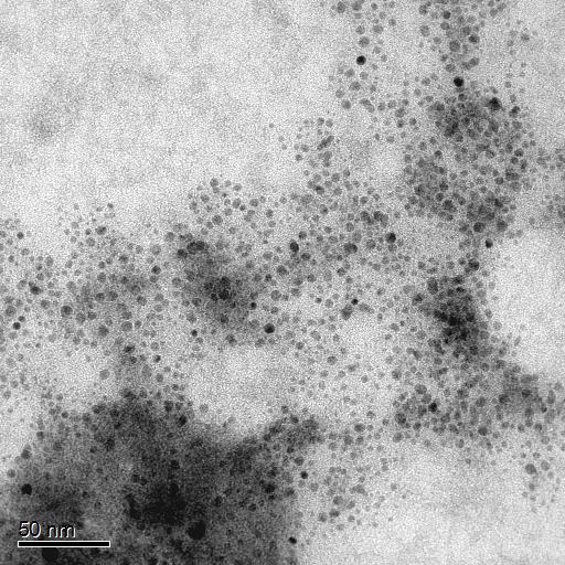 TEM image of TiO2 nanoparticles taken at 50KX magnification demonstrates discrete and stable end product.