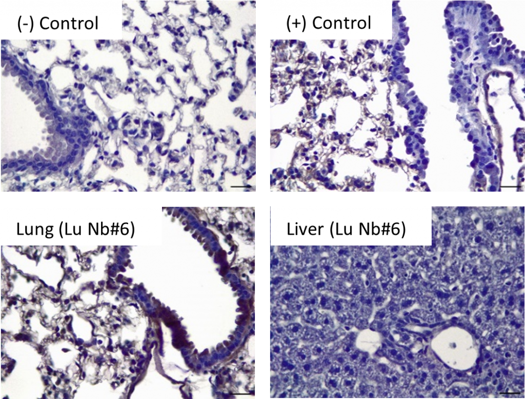 Image of Immunohistochemistry (IHC) Readout