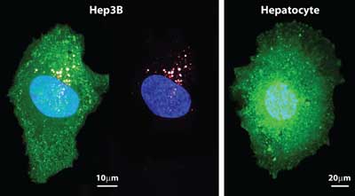 DEEP IMPACT-The figure on the left (Hep3B) shows a greenly fluoresced cancerous liver cell penetrated by protocells. The small red dots are lipid bilayer wrappings. Their cargo - drug-filled nanoparticles, their pores here filled with white fluorescent dyes for imaging purposes - penetrate the cancerous cell. (Penetration is more clearly seen in the second image, where the green fluorescence has been removed.) The normal cell on the right (hepatocyte) shows no penetration. (Images, courtesy Carlee Ashlee, were taken with a confocal microscope at the University of New Mexico cancer center's Fluorescence Microscopy Facility.)