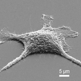 Image of <p> Zombie cell, first stage — Only moderately heated, the cell is now pure silica, and needed to be coated in gold for a scanning electron microscope to image it. (Image courtesy of Bryan Kaehr)</p>